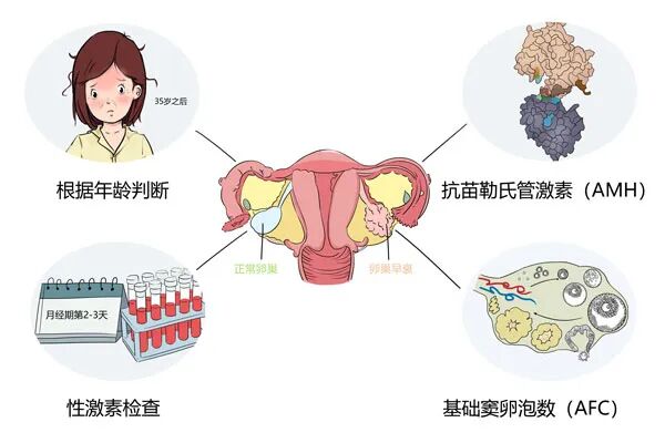AMH、激素六项及基础窦卵泡与卵巢的关系