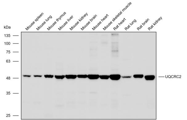 抗体产品星推荐第二十六期|Anti-UQCRC2 Polyclonal Antibody
