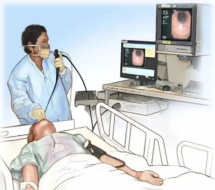 可视喉镜是什么嗓子不舒服要做喉镜？别紧张！带您了解喉镜检查的全过程_https://www.jmylbn.com_新闻资讯_第2张