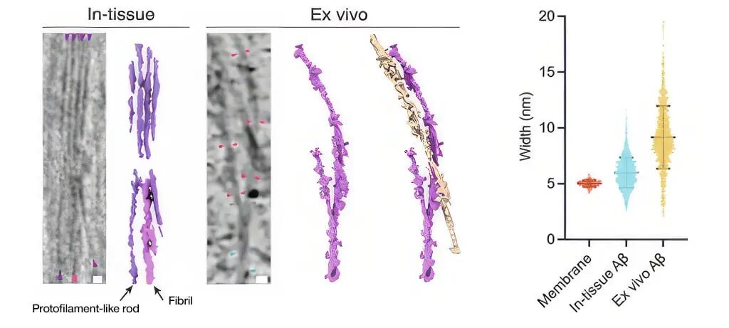 解碼tau蛋白：解開(kāi)阿爾茲海默癥的「蛋白密碼」