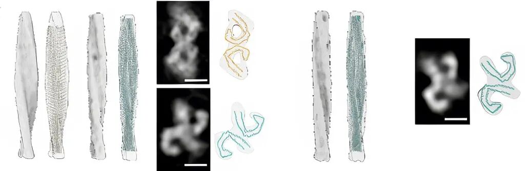 解碼tau蛋白：解開(kāi)阿爾茲海默癥的「蛋白密碼」