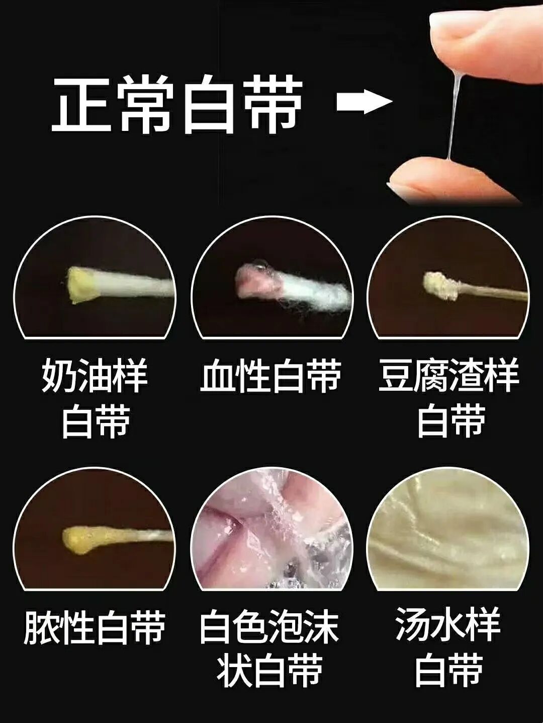 AED怎么自检豆腐渣？鱼腥味？颜色不对？这份白带自检攻略请收好！_https://www.jmylbn.com_新闻资讯_第8张