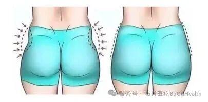 ͼʾ, ʾ��ͼ

�жȿ��Ŷ��������Զ�����:ver1