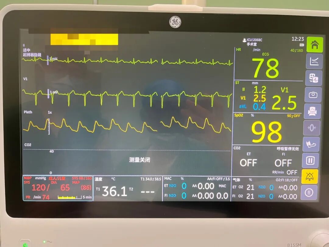 无影灯有什么特点“一科一特色”展播 ｜ 手术室优质护理服务——无影灯下温暖的“手护”_https://www.jmylbn.com_新闻资讯_第7张