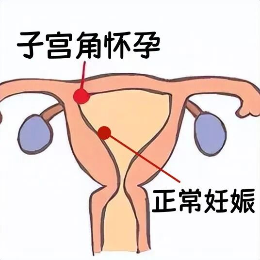 下载_副本.jpg