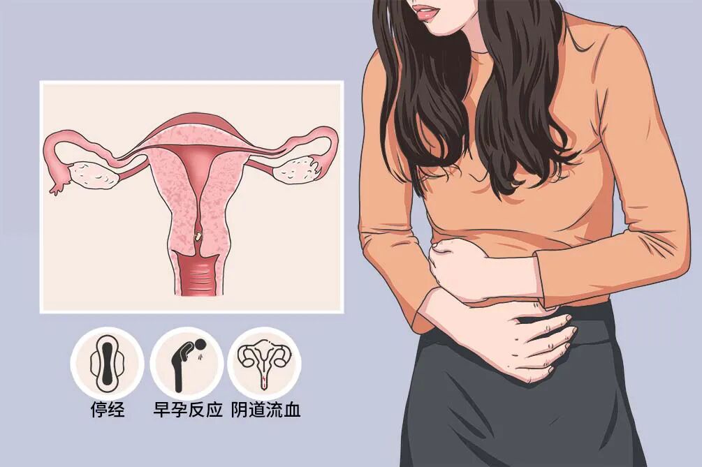 ABE23CB4D4EE70ABCC5FF280A699DCBC.jpg