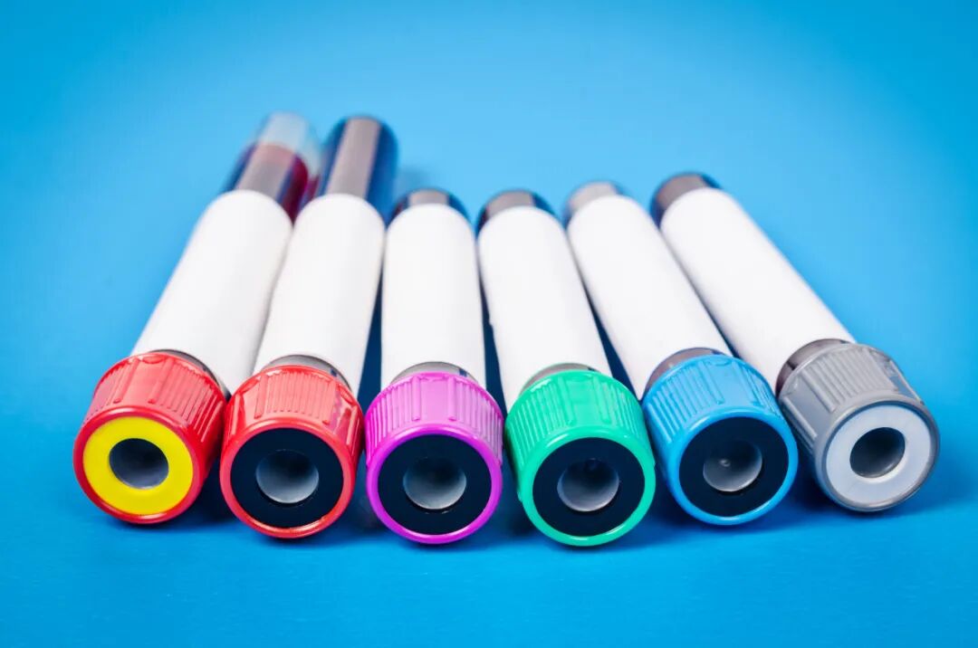 采血管颜色代表什么【健康知识普及行动】认识五颜六色的采血管_https://www.jmylbn.com_新闻资讯_第7张