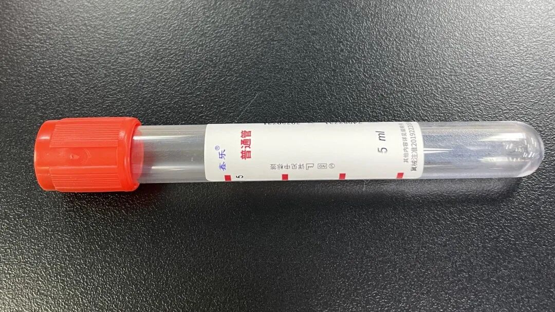 采血管颜色代表什么【健康知识普及行动】认识五颜六色的采血管_https://www.jmylbn.com_新闻资讯_第11张