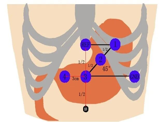 肠电图能查看什么【医疗科普】如何做好胃肠电图检测？_https://www.jmylbn.com_新闻资讯_第8张