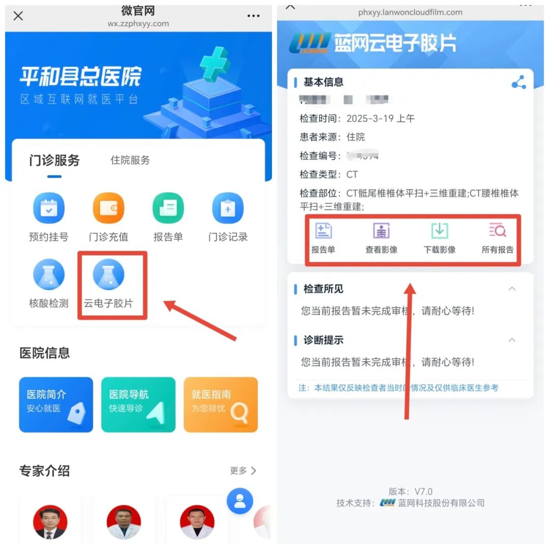 放射科怎么打印【为民办实事】超便捷！快来了解“云胶片”，影像报告手机就能随时看！_https://www.jmylbn.com_新闻资讯_第10张