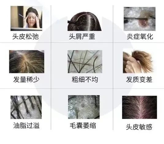 霜降养发正当时，丝华诺与你一起科学护发