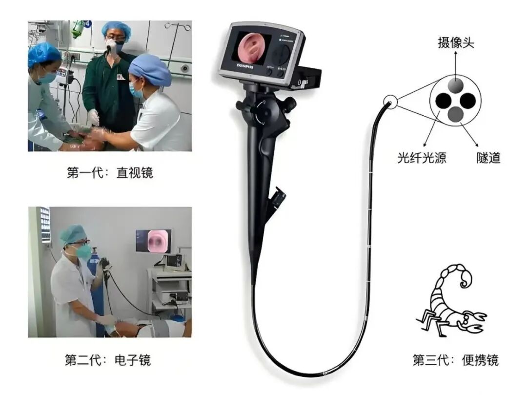 icu里有哪些医用仪器揭秘ICU：那些守护生命的“秘密武器”_https://www.jmylbn.com_新闻资讯_第12张