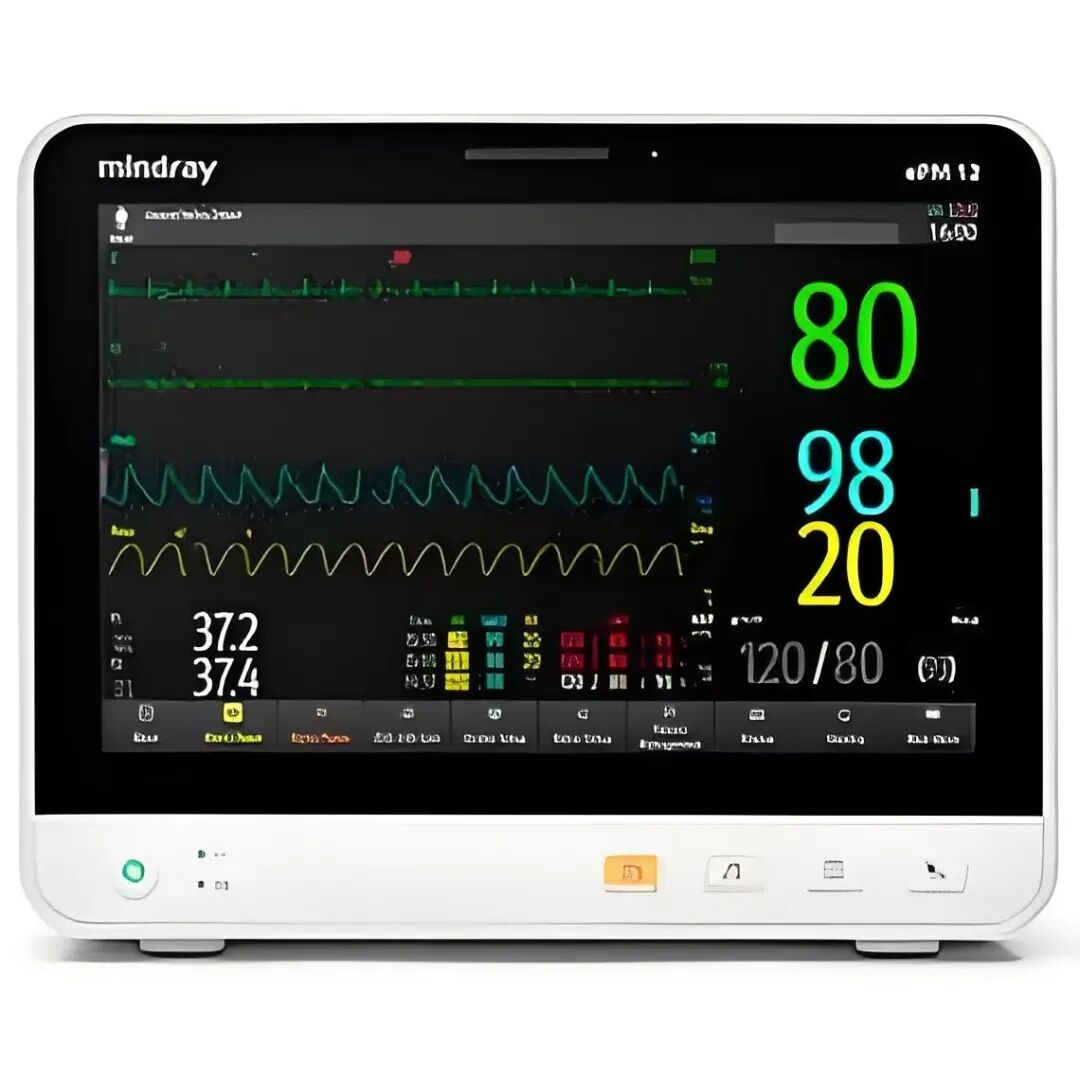 icu里有哪些医用仪器揭秘ICU：那些守护生命的“秘密武器”_https://www.jmylbn.com_新闻资讯_第4张