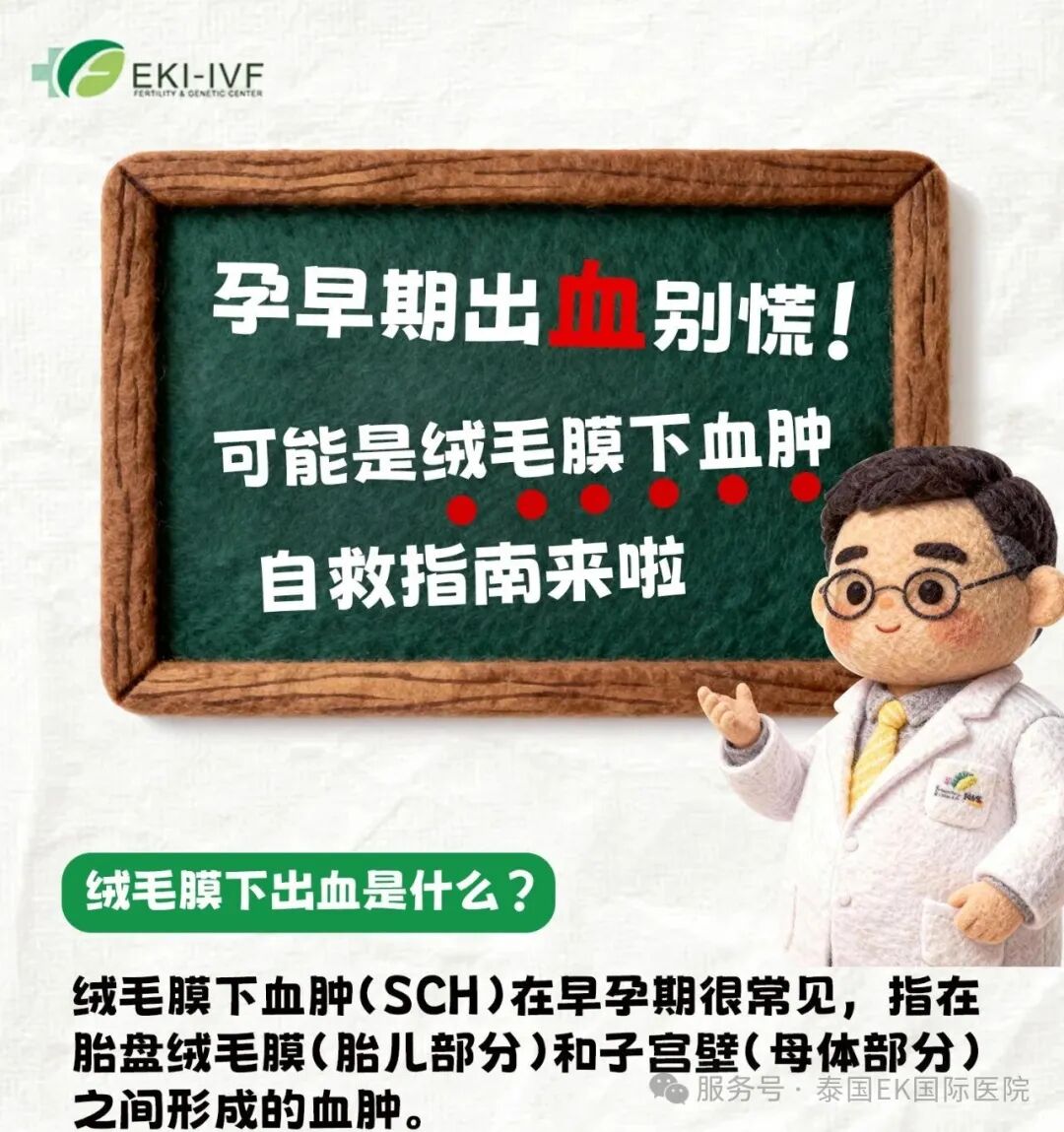 泰国三代试管 孕早期出血可能是——绒毛膜下血肿(宫腔积液)