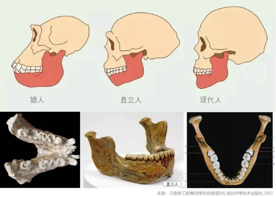 阻生齿_画板 1.jpg