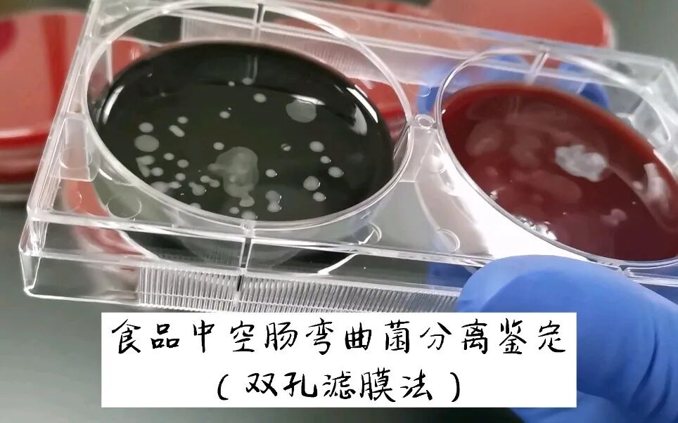 聚焦GB 4789.9-2025彎曲菌檢驗：關鍵步驟操作要點與高效解決方案