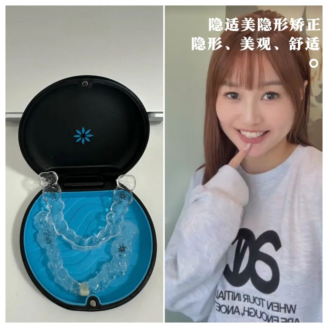 慈友故事 |  32岁生日，在慈恩齿科送自己一份自信笑容