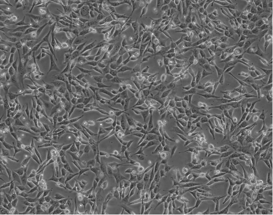 細(xì)胞攻略 | HT-22(小鼠海馬神經(jīng)元細(xì)胞)培養(yǎng)教程