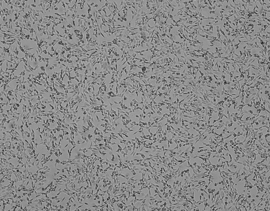 細(xì)胞攻略 | HT-22(小鼠海馬神經(jīng)元細(xì)胞)培養(yǎng)教程