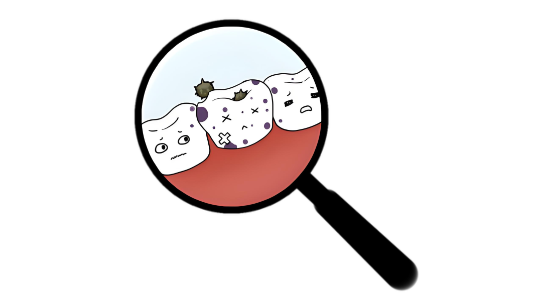 孩子牙齿上有黑点是蛀牙？别慌，也有可能是色素沉着