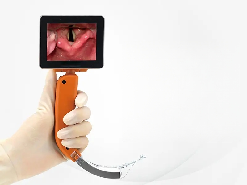 可视喉申请怎么【麻醉科】全身麻醉手术“隐形守护者”：可视喉镜气管插管，你了解吗？_https://www.jmylbn.com_新闻资讯_第2张