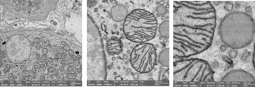 透視生命結(jié)構(gòu)之美，共探電子顯微新篇章