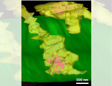 以電鏡視角切入神經(jīng)科學(xué)的跨尺度研究（三）癌癥、離子通道、感官受體研究
