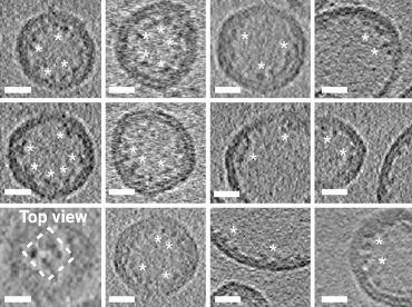 以電鏡視角切入神經(jīng)科學(xué)的跨尺度研究（三）癌癥、離子通道、感官受體研究