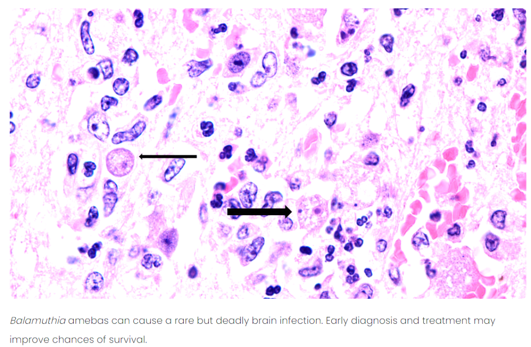 【热点速递】环肽药物研发新突破：发现抗“食脑变形虫”强效环肽