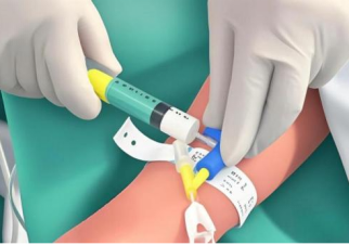 什么是面罩麻醉手术室最神秘的瞬间：扣上面罩秒睡的真相_https://www.jmylbn.com_新闻资讯_第4张