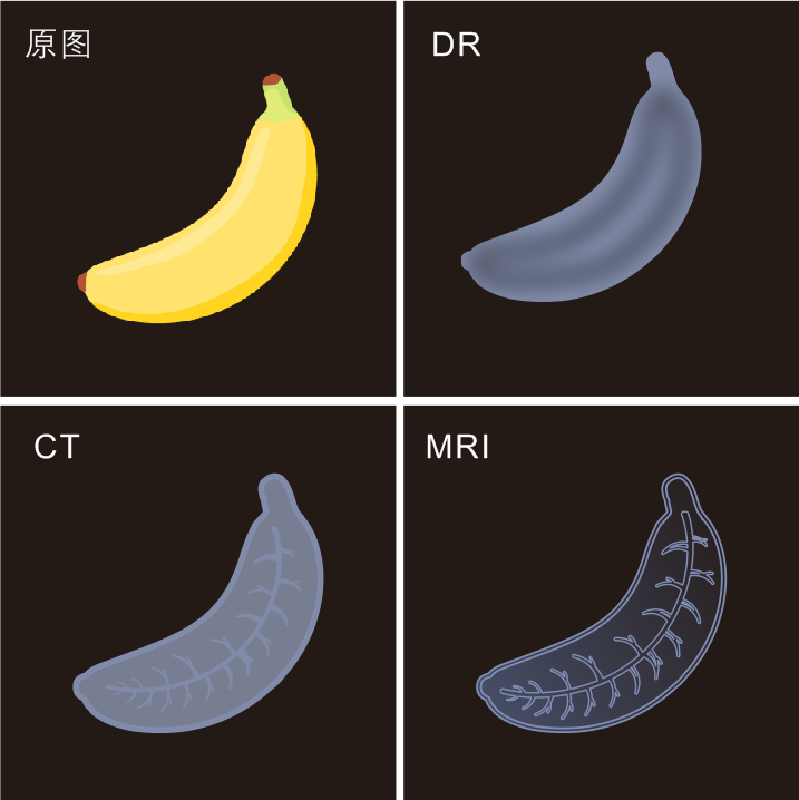 x射线为什么叫dr辐射？磁场？X光？一次说清DR、CT、MRI，带你揭开“拍片子”的神秘面纱_https://www.jmylbn.com_新闻资讯_第5张