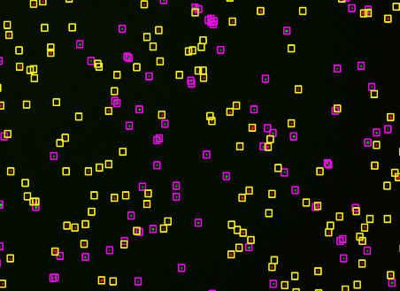 喜報(bào)丨IND獲批！瑞宏迪醫(yī)藥細(xì)胞治療藥物RGL-305注射液正式獲NMPA批準(zhǔn)臨床