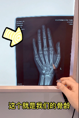 身高管理新时代：告别“听天由命”，拥抱科学成长！(图2)