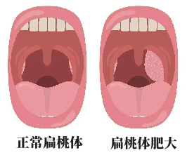 81d9deb749967fdb68d63e0ea8b9f7e4_副本.png