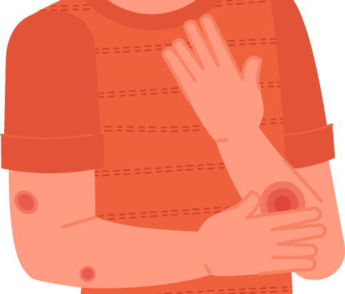 抗菌清创敷料有什么用骨科换药全攻略：不只是“换纱布”那么简单_https://www.jmylbn.com_新闻资讯_第4张