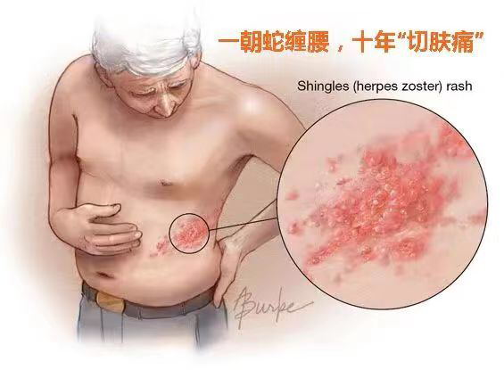http://mmecoa.qpic.cn/mmecoa_png/RvnicNZF8SJOHmAdYpxsTMia53o1s1TkRm4UHhrcgUtg9ibuPkicmCX9PKKWCMGic2Pj3uApGfJAc0rPOXpI5b8VEXw/0?wx_fmt=png