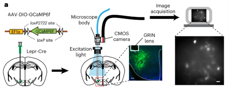 【客户文章】童年创伤如何改写大脑 “食欲密码”？科学家揭示暴食背后的神经环路