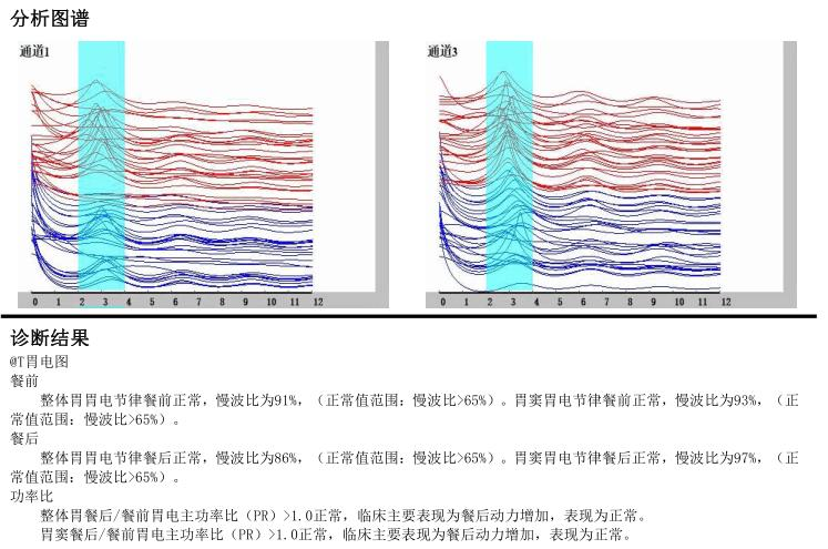 肠电图能查看什么【医疗科普】如何做好胃肠电图检测？_https://www.jmylbn.com_新闻资讯_第10张