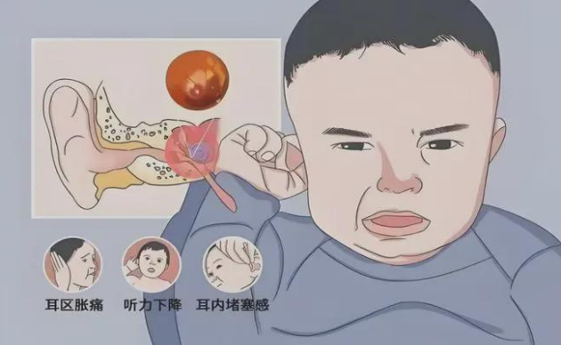 中耳筛查怎么做孩子听力筛查没通过？解密耳朵里的“积液密码”_https://www.jmylbn.com_新闻资讯_第43张