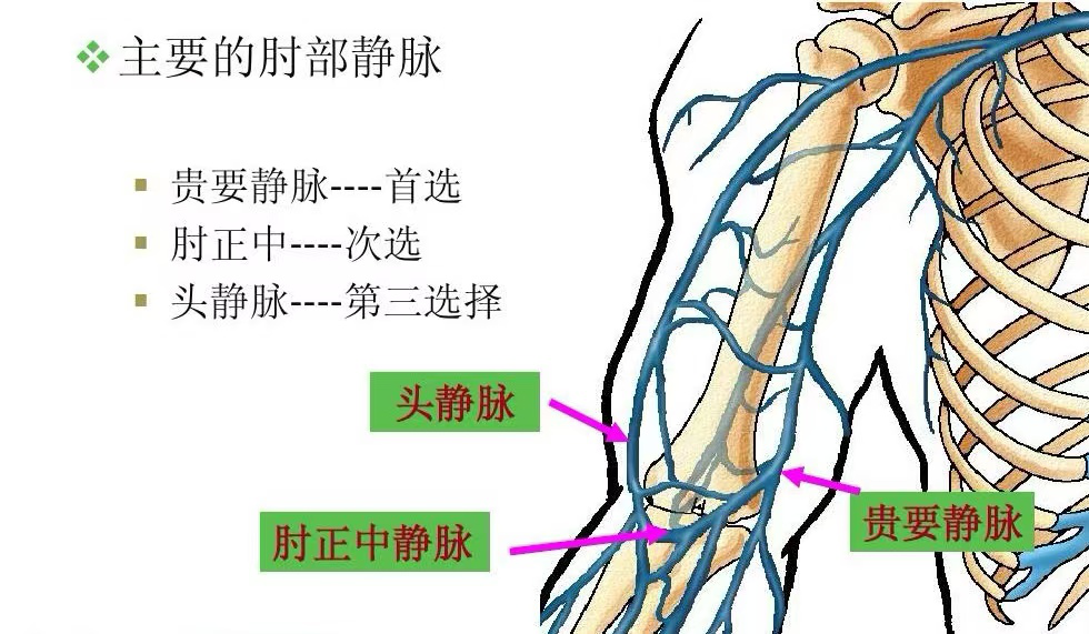 为什么输血不能用小针手术室里的“针”学问_https://www.jmylbn.com_新闻资讯_第6张