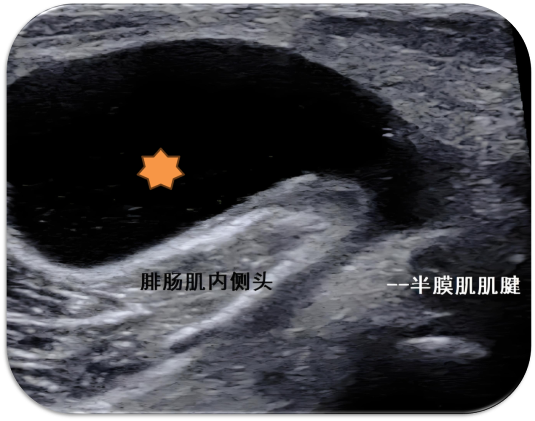 44ad36eb5d4d3e037fb38472e59eb909.png