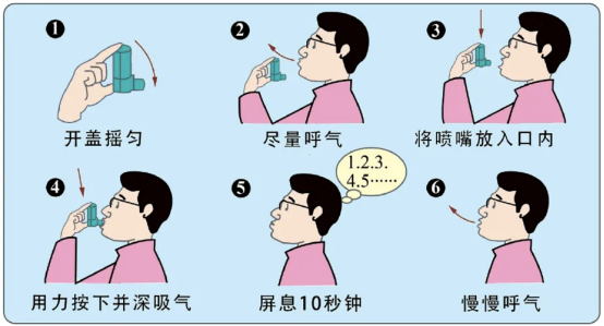 新呼泰怎么用【科普】如何正确使用哮喘药_https://www.jmylbn.com_新闻资讯_第14张