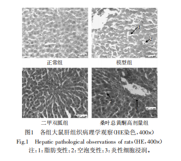 桑叶总黄酮：改善2型糖尿病肝损伤的天然活性产物