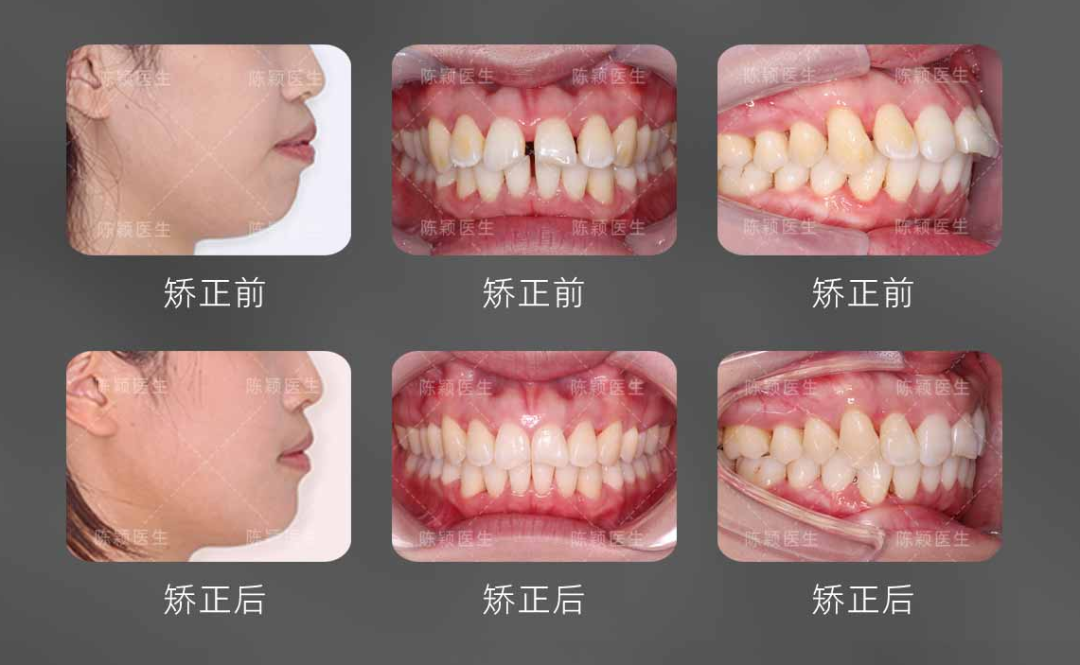慈恩名人堂 | 陈颖：深耕美学正畸，用千例矫治雕琢自信笑颜