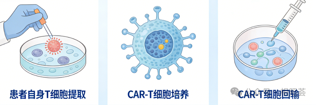 自体、异体、通用型：三种CAR-T来源，哪种更适合你？
