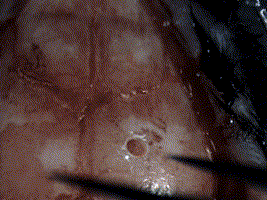 技術實操丨從“開窗