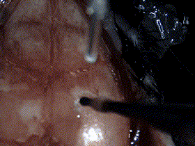 技術實操丨從“開窗