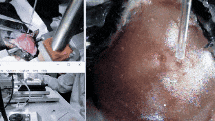 技術實操丨從“開窗