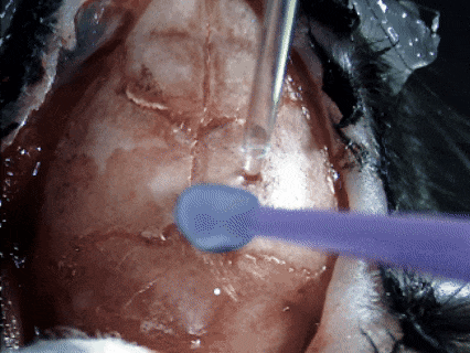 技術實操丨從“開窗