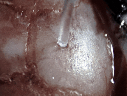 技術實操丨從“開窗